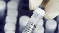 Morphosys erhält Meilensteinzahlung von Bayer für späten Forschungserfolg