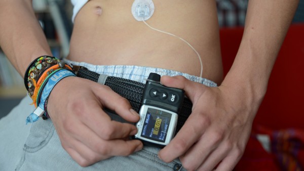 Ultraschnelles Insulin aspart steht vor Zulassung
