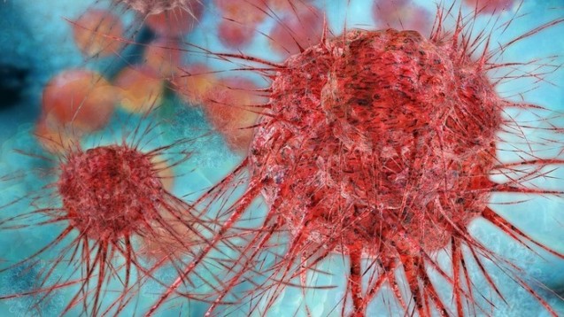 Krebszelle: Nichtinvasiver Ansatz könnte Metastasen der Schildwächter ausschließen. (Foto: Fotoliaxrender - Fotolia)