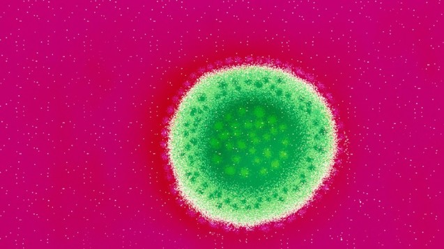 Das Lassavirus gehört zur Familie der Arenaviren. Die Viruspartikel sind polymorph, mit variablem Durchmesser (80–300 nm). (Mikroskopaufnahme: dpa)