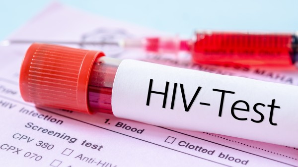 Ministerium prüft Zulassung von HIV-Schnelltests für zu Hause