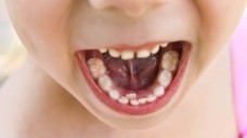 Probleme mit den Zähnen? Für Londoner Eltern ist einer Untersuchung zufolge nicht der Zahnarzt die erste Anlaufstelle. (Foto: Victoria М / stock.adobe.com)                                    