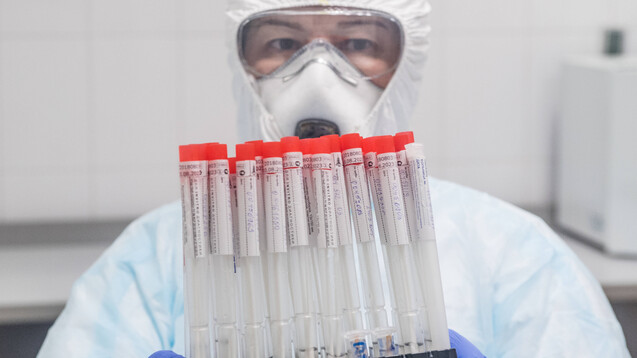 Bundesgesundheitsminister Jens Spahn (CDU) hat am heutigen Freitag mitgeteilt, dass er das Testverfahren auf COVID-19 umstellen will, um gezielter zu testen. (b/Foto: imago images / Xinhua)