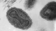 Pockenviren unter dem Elektronenmikroskop. (Foto: CDC / Dr. Fred Murphy)