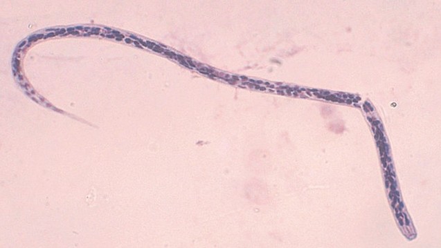 Bisher unerkannt: MCM-Nervenzellen beeinflussen den Fadenwurm Caenorhabditis Elegans (Bild: CDC)