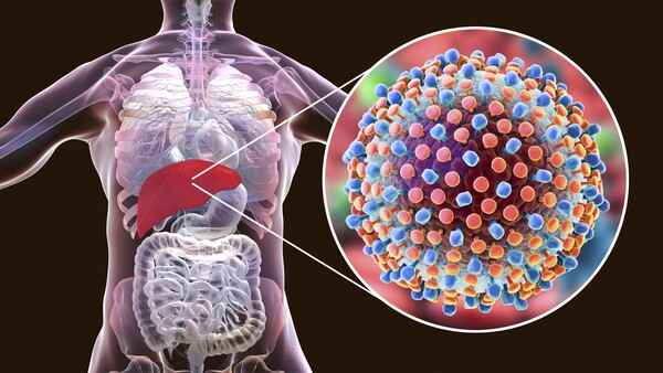 Studie: Warum sich die Ausheilung chronischer Hepatitis C lohnt