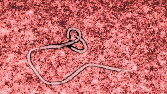 Für den Ebola-Impfstoff wurden Gene des Ebola-Virus&nbsp; (hier im Bild) in einen replikationsfähigen viralen Vektor eingefügt, der auf dem Vesicular Stomatitis Virus (VSV) basiert. (s / Foto: imago images / Panthermedia)