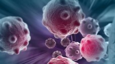 Krebszellen: Evofosfamide gegen das Pankreaskarzinom wurde in Phase-III-Studien untersucht. (Foto: Vitanovski - Fotolia)