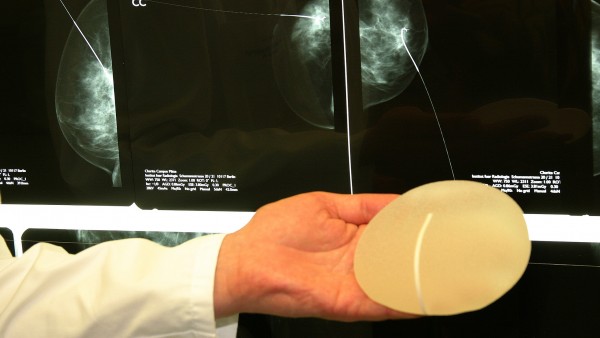 TÜV Rheinland gerät wegen Brustimplantaten unter Druck