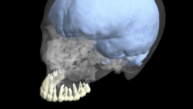 Die Wissenschaftler werteten für ihre Studie Daten von Zahn- und Gehirngrößen aus. (Foto: George Washington University)