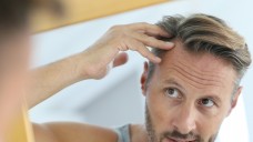Wehret den Anfängen: Viele Männer erkundigen sich bei beginnendem Haarausfall in der Apotheke nach Haarwuchsmitteln. (Foto: goodluz / Fotolia)