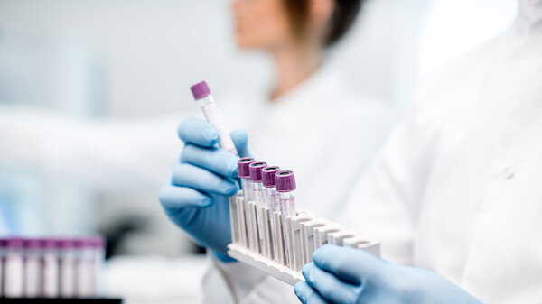 Packungsbeilage muss vor falschen Laborwerten unter Biotin warnen