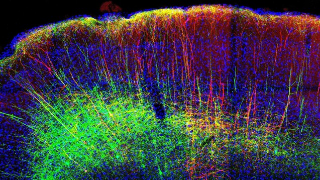 Mit bildgebenden Verfahren konnten Forscher die Aktivität der Nervenbahnen in Mäusegehirnen genau verfolgen. (Foto: Universitätsklinikum Heidelberg)