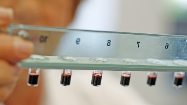 Wie ist das Nutzen-Risiko-Verhältnis von Xarelto? Eine Bayer-Wissenschaftlerin analysiert Blutproben. (Foto: picture alliance / dpa)