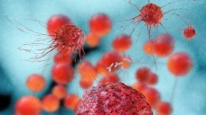 Forscher haben einen neuen Therapieansatz zur Behandlung von Leukämie und Prostatkrebs entdeckt. (Foto: fotoliaxrender/Fotolia)