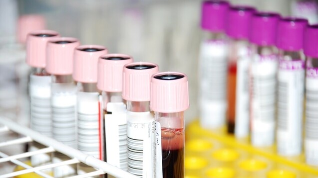 Ärzte können jetzt Antikörpertests auf SARS-CoV-2 abrechnen. ( r / Foto: littlebell/ stock.adobe.com)