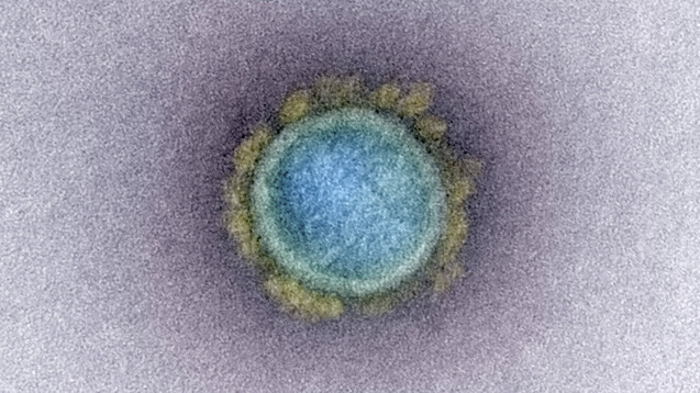 Wie ist die derzeitige Lage beim Coronavirus? Was ist noch unklar? Was könnte uns Hoffnung geben? Wann könnte es Arzneimittel und Impfstoffe geben? DAZ-Autorin Dr. Helga Blasius bietet einen Überblick. (c / Foto: imago images / ZUMA)