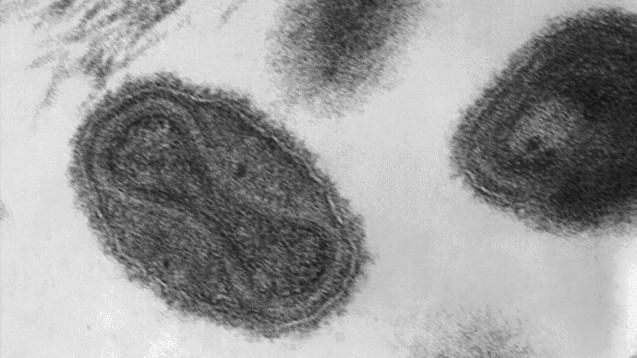 Die gefährlichen Viren unter dem Elektronenmikroskop. (Foto: CDC / Dr. Fred Murphy)