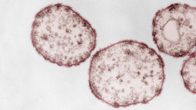 Umstritten: Erfüllten die vorgelegten Studien die Auslobung? Ein Impfgegner wollte Beweise, dass Masernviren existieren - und ihren Durchmesser wissen. (Quelle: RKI)