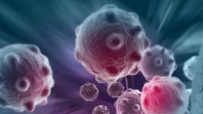 Krebszelle: Forscher wollten wissen, was ASS bewirkt. (Illustration: vitanovski - Fotolia)