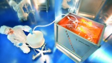 Abfüllung in sterile Einweg-Bags in der Produktion von Biopharmazeutika. (Foto: Sartorius)