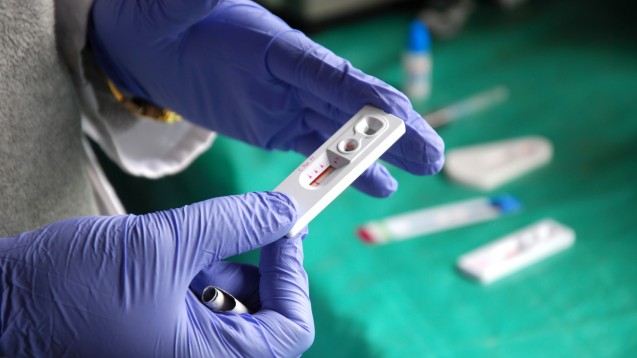 Der Berliner Senat plant auch für Nicht-Versicherte HIV-Patienten eine Clearingstelle um die Behandlungsquote in der Stadt zu erhöhen. (Foto: francovolpato / stock.adobe.com)