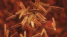  Mycobacterium Tuberculosis bildet vermehrt Resistenzen gehen Therapeutika. (Foto: Imago / spl)