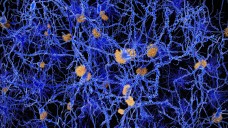 Der Antikörper Solanezumab soll Plaque-Ablagerungen reduzieren und so zu einer Verbesserung von Alzheimer-Symptomen führen, konnte in einer großen Studie nun jedoch nicht überzeugen. (Foto: Juan Gärtner / Fotolia)