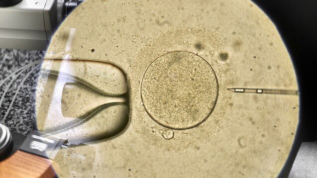 Blick durch das Mikroskop bei einer In-vitro-Fertilisation. (x / Foto: Andriy Bezuglov / AdobeStock)