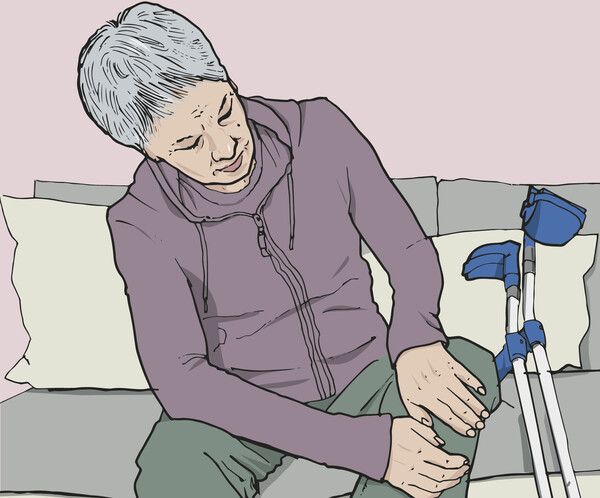 Eine Patientin mit Psoriasis-Arthritis