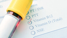 Die Ursachen für einen Vitamin-B12 -Mangel können vielfältig sein: So kann die Zufuhr von Vitamin B12 ungenügend sein, die Aufnahme reduziert oder der Bedarf erhöht. (b / Foto: jarun011 / stock.adobe.com)