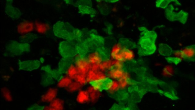 Sobald Killerzellen (rot)
Wind von einer Infektion bekommen, rufen sie eine Art Mitarbeiterstab aus. (Foto: AG Kastenmüller / Universität Bonn)
