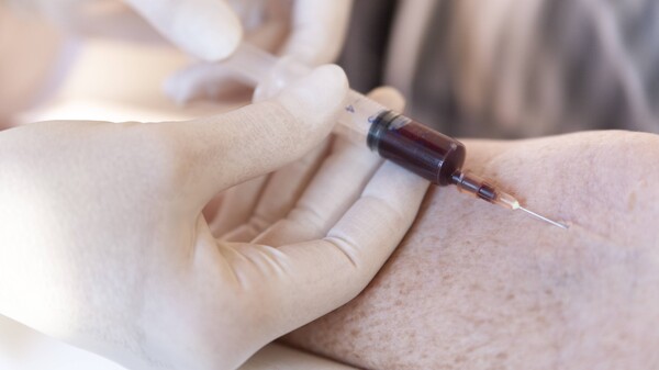 Keine Blutentnahme durch Heilpraktiker&nbsp;für Eigenblutprodukte
