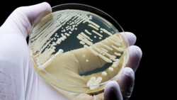 Candida auris kann im Gegensatz zu anderen Candida-Arten durch Schmierinfektion von Mensch zu Mensch oder über kontaminierte Oberflächen übertragen werden. (Foto: TopMicrobialStock / AdobeStock)