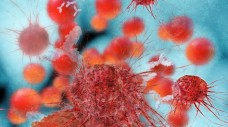 Krebszelle: Entdeckte Biomarker sollen nun weiter untersucht werden. (Foto: fotoliaxrender - Fotolia)