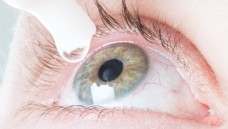 Heute im Beratungs-Quickie: Eine Verordnung über Augentropfen zur Glaukomtherapie. (Foto: dpa)