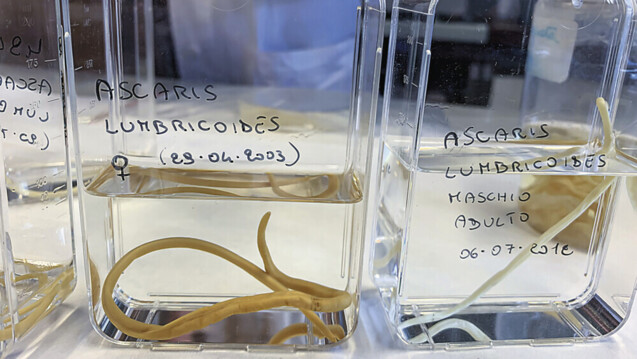 Ascaris lumbriocodes ist ein parasitärer Wurm, der in Menschen und Affen auftritt. Die Larven befallen Lunge und Atemwege, die adulten Würmer befinden sich im Verdauungstrakt des Wirts. Foto: Lara/AdobeStock