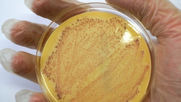 Befunde Staphylococcus aureus: Wie lang muss bei MRSA behandelt werden? (j / Symbolbild: oleksandr / stock.adobe.com)