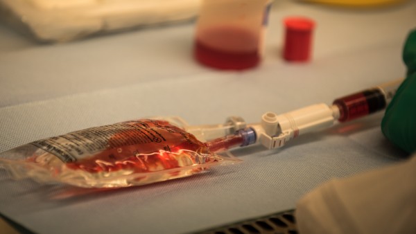 Richtiger Umgang mit Zytostatikainfusionen in der Krebstherapie