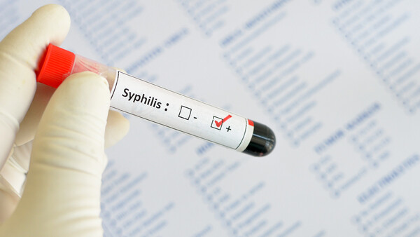 2017 wieder mehr Syphilis-Fälle