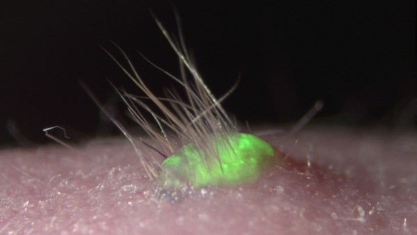 Stammzellforscher produzieren Haut mit Haaren