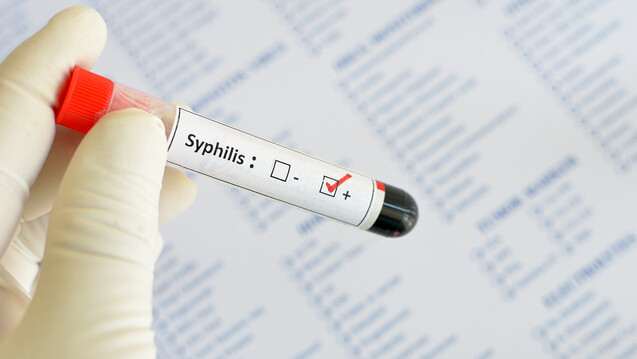 In der aktuellen Ausgabe des epidemiologischen Bulletins hat das RKI aktuelle Zahlen zu Syphilis-Infektionen veröffentlicht. (r / Foto: jarun011 / stock.adobe.com)                                         
