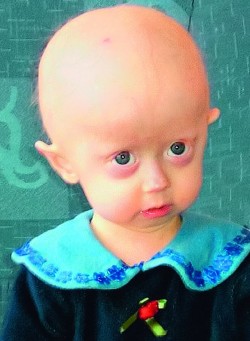 D472011_pri_progerie.jpg