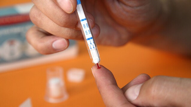 Mit einem Pieks besteht Klarheit, ob eine HIV-Infektion vorliegt. Ab Herbst sollen Bürger HIV-Schnelltests auch zuhause durchführen können. Die ABDA findet, dass diese Tests apothekenpflichtig sein müssen.  (Foto: Imago)