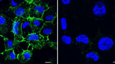 LecA (grün) bindet an die Oberfläche von Wirtszellen (linkes Bild). Bei Zugabe eines der neu entwickelten glycomimetischen Inhibitoren (rechtes Bild), wird das Binden von LecA verhindert. (Bild: Francesca Rosato, Dorina Reith/University of Freiburg | helmholtz-hips.de)