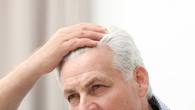 Ein prominentes Beispiel für unerwünschte Wirkungen von MTX ist Haarausfall. Alopezie ist jedoch meist keine Folge von der Therapie, sondern eher in der Grunderkrankung begründet. Die Patienten sollten beruhigt werden, dass sich das oft subjektiv wahrgenommene Problem meist von selbst löst. (Foto: New Africa / AdobeStock)