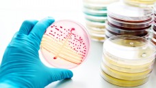 In den USA haben Forscher einen 30-minütigen Schnelltest zur Erkennung von Antibiotika-Resistenzen entwickelt. (Foto: fotolia / jarun011)