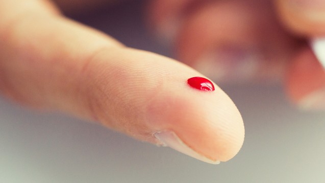 Ein Tropfen Blut soll genügen: Schweizer können sich wahrscheinlich demnächst zu Hause selbst auf HIV testen. (Foto: Syda Productions / stock.adobe.com)                               
