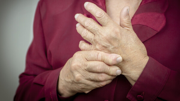 Rote-Hand-Brief: Mehr Myokardinfarkte und maligne Erkrankungen unter Tofacitinib 