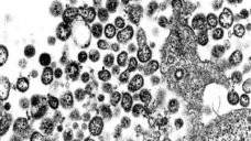 Die elektronenmikroskopische Aufnahme zeigt Lassaviruspartikel aus Zellkulturen, gezüchtet am Bernhard-Nocht-Institut für Tropenmedizin in Hamburg. (Aufnahme: BNI / Tropeninstitut Hamburg / dpa)
